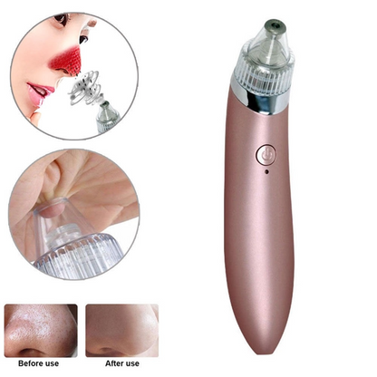 Electric Blackhead Remover Pore Vacuum with 4 Heads, Facial Suction Device for Clear, Smooth Skin
