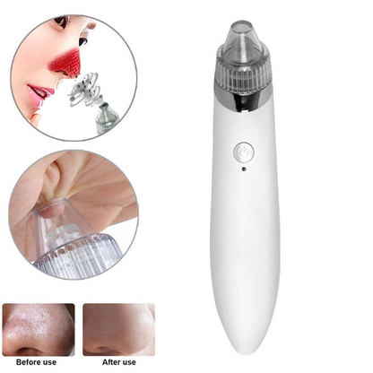 Electric Blackhead Remover Pore Vacuum with 4 Heads, Facial Suction Device for Clear, Smooth Skin